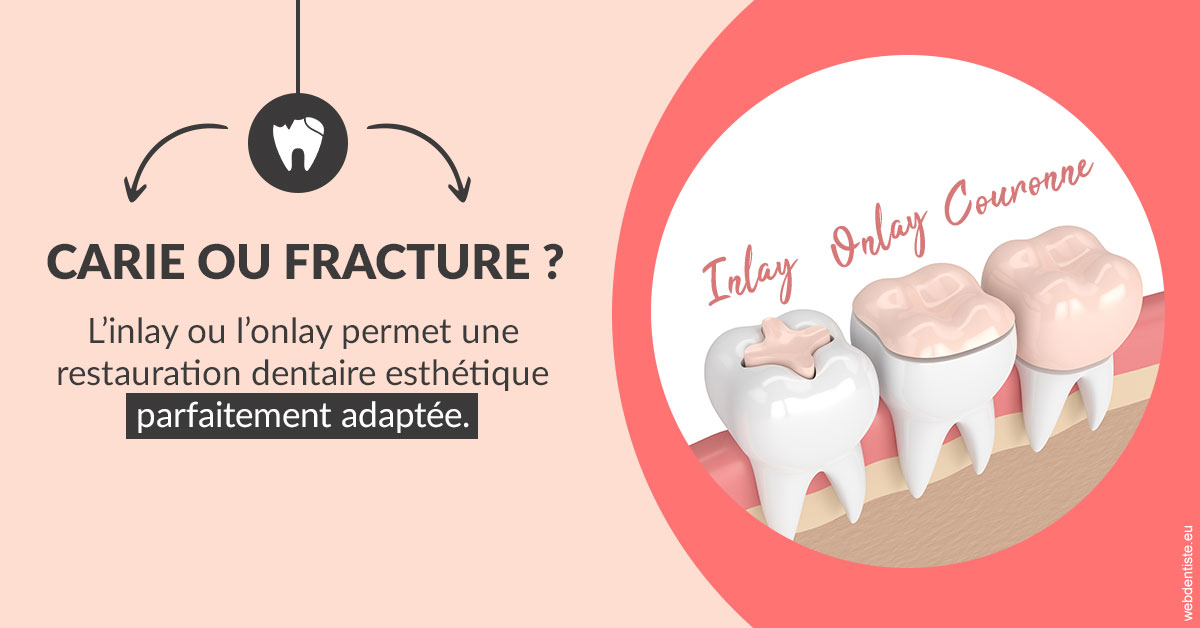 https://www.orthodontiste-demeure.com/T2 2023 - Carie ou fracture 2