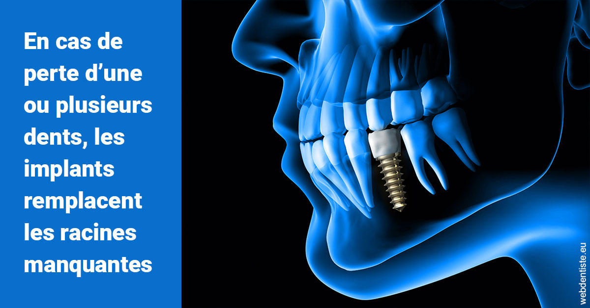 https://www.orthodontiste-demeure.com/Les implants 1