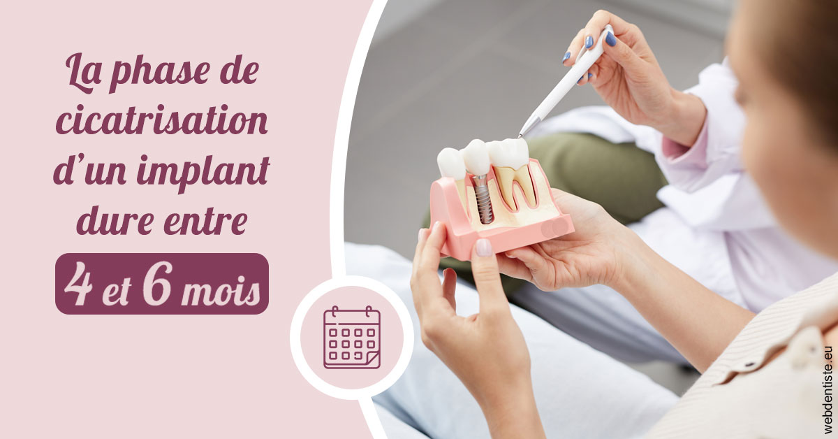 https://www.orthodontiste-demeure.com/Cicatrisation implant 2