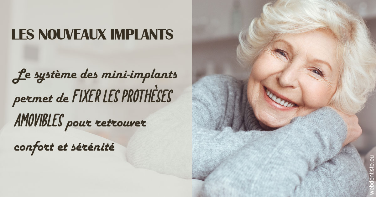 https://www.orthodontiste-demeure.com/Les nouveaux implants 1