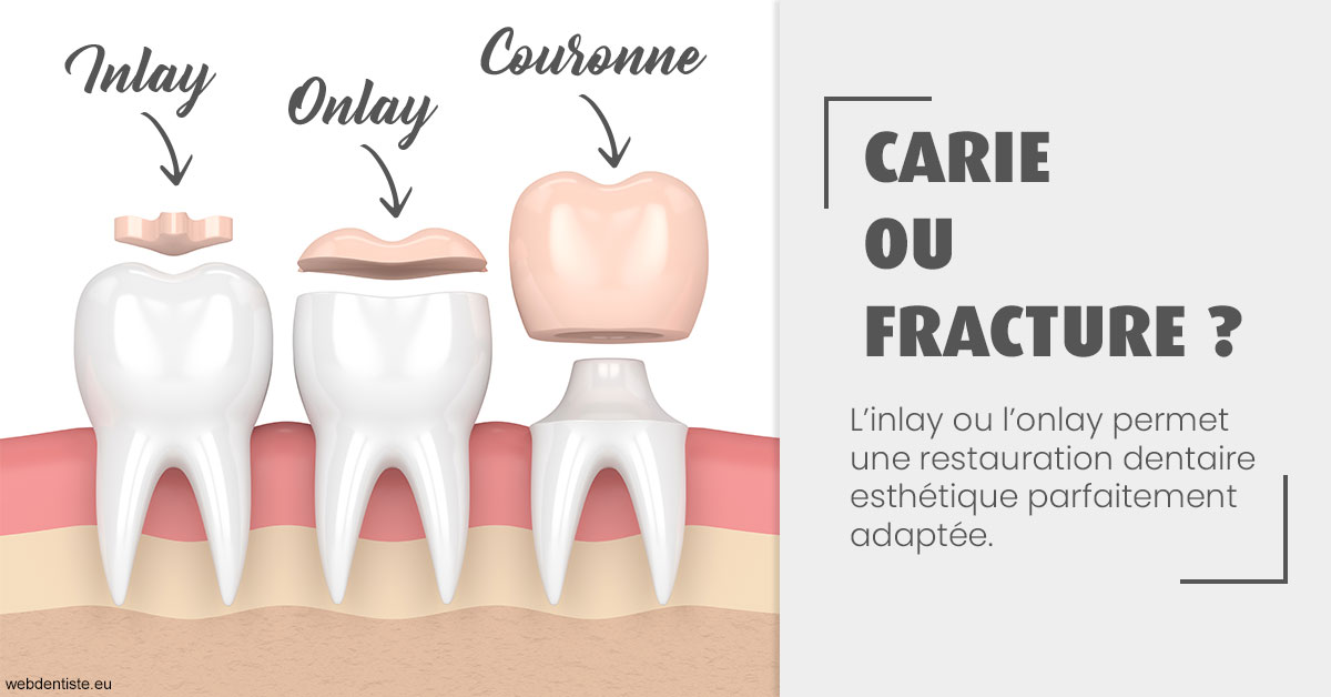 https://www.orthodontiste-demeure.com/T2 2023 - Carie ou fracture 1