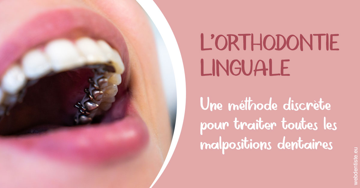 https://www.orthodontiste-demeure.com/L'orthodontie linguale 2