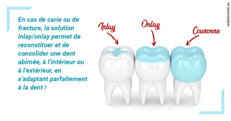 https://www.orthodontiste-demeure.com/L'INLAY ou l'ONLAY