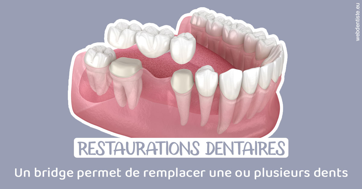 https://www.orthodontiste-demeure.com/Bridge remplacer dents 1