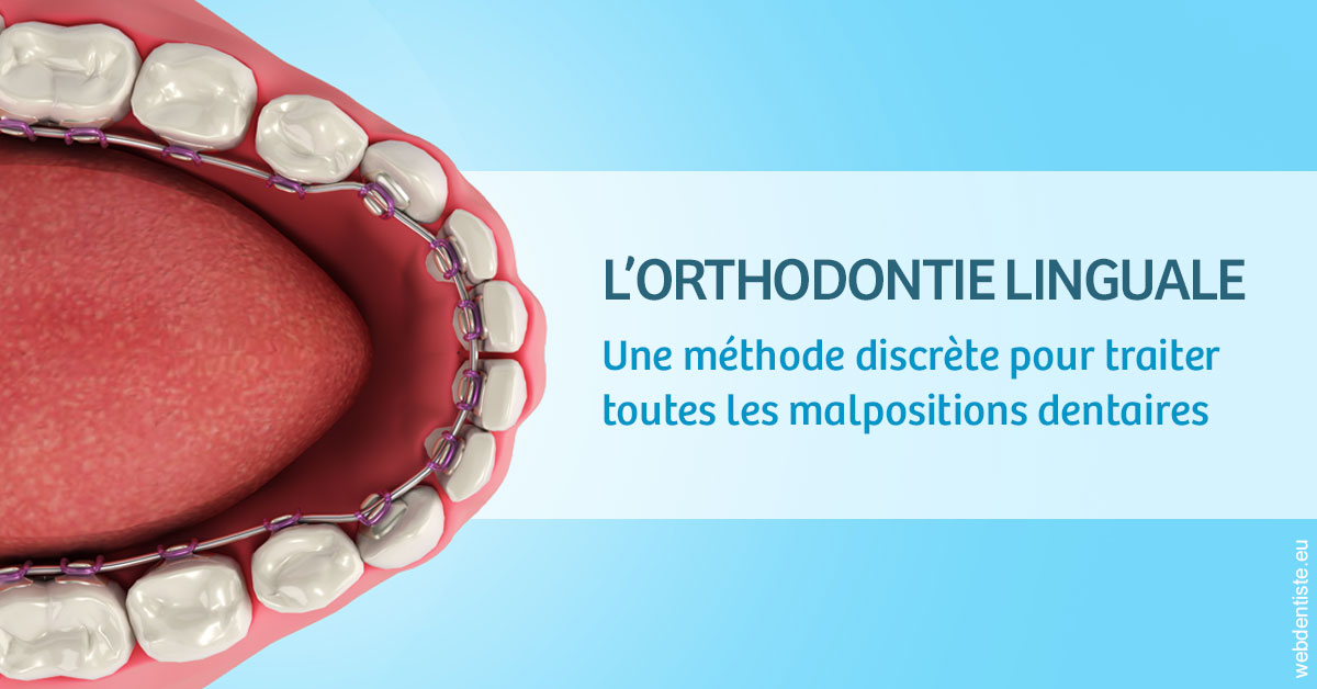https://www.orthodontiste-demeure.com/L'orthodontie linguale 1