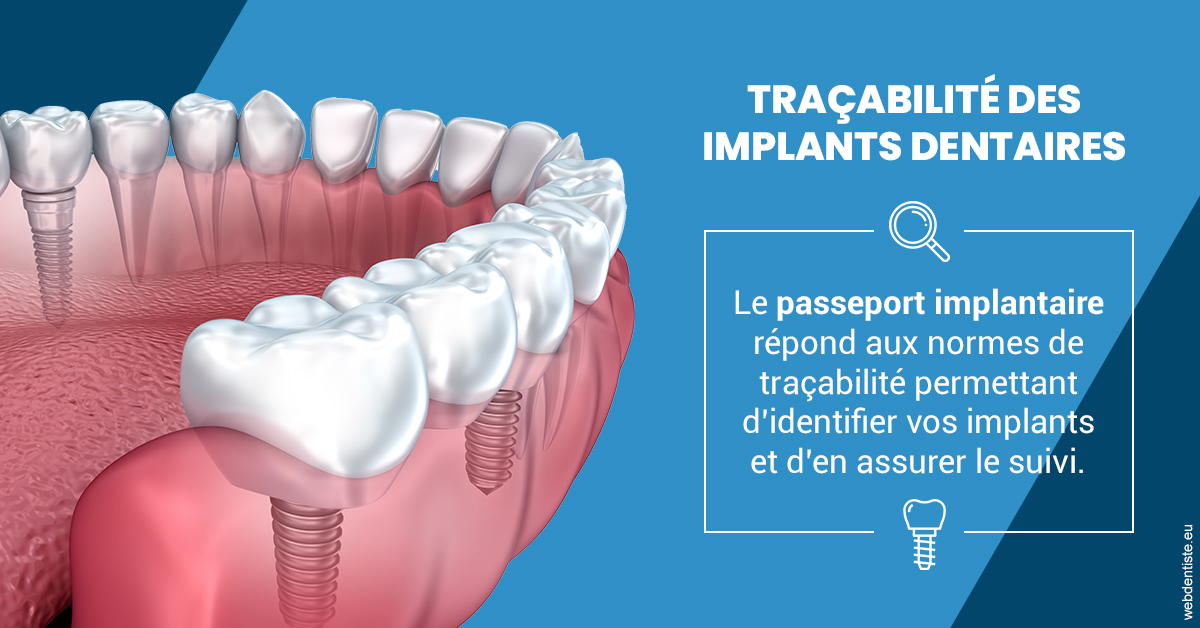 https://www.orthodontiste-demeure.com/T2 2023 - Traçabilité des implants 1