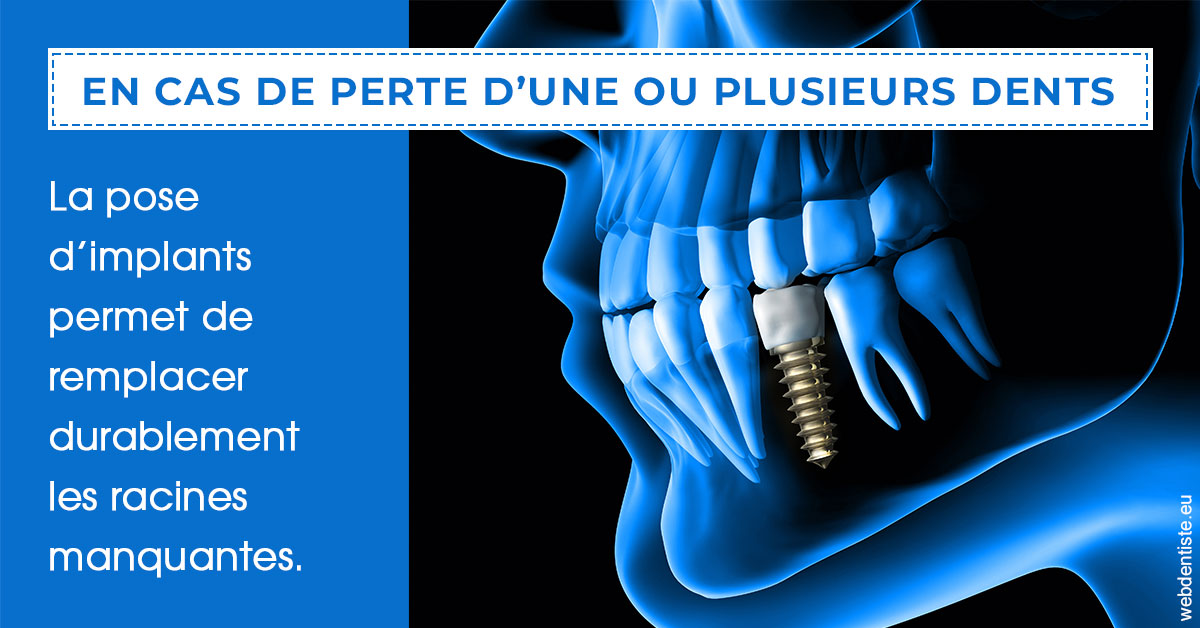 https://www.orthodontiste-demeure.com/2024 T1 - Implants 01