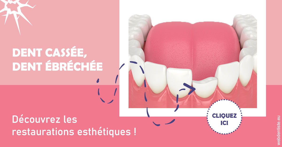 https://www.orthodontiste-demeure.com/Dent cassée ébréchée 1