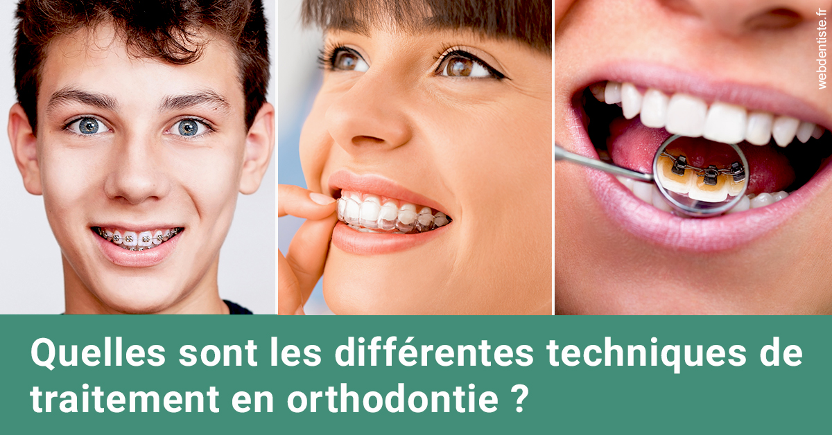 https://www.orthodontiste-demeure.com/Les différentes techniques de traitement 2