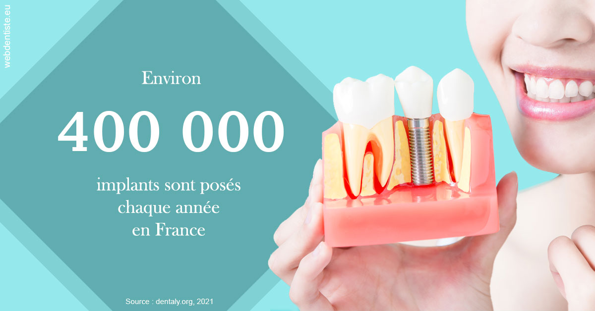 https://www.orthodontiste-demeure.com/Pose d'implants en France 2