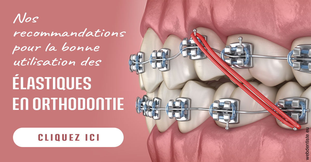 https://www.orthodontiste-demeure.com/Elastiques orthodontie 2